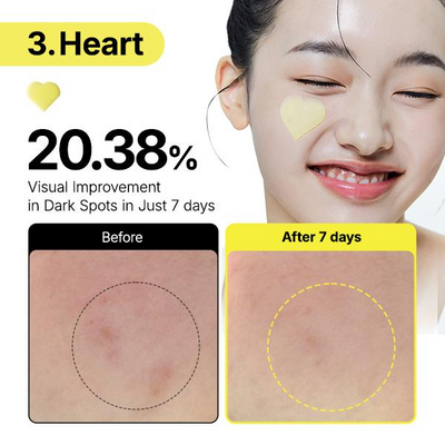 Glutathione 7 Dark Spot Serum